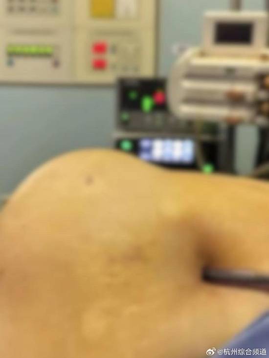 辣妈模仿Ella真空腹肚子练出洞 果然不要轻易模仿