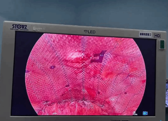 辣妈模仿Ella真空腹肚子练出洞 果然不要轻易模仿